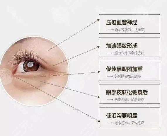 下眼袋浮腫怎么辦?