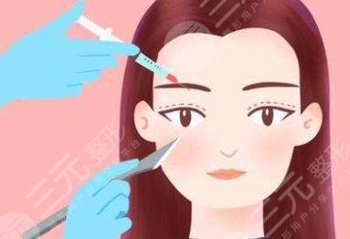 雙眼皮