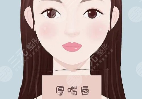 厚唇變薄手術(shù)多少錢？