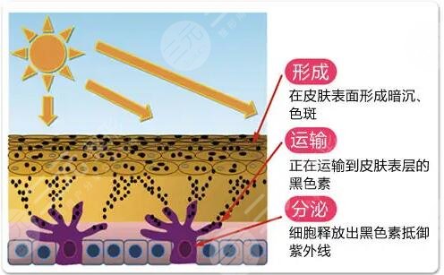 激光美白的價(jià)格是多少?
