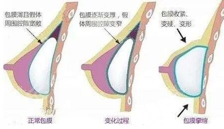 豐胸產(chǎn)品真的有用嗎