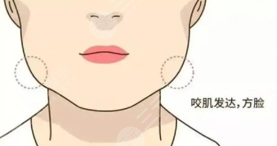 咬肌怎么變小快速的方法不動(dòng)刀！照搬文中的方法可以讓你更快的變小臉~