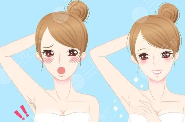 脫毛膏