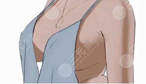 運動豐胸