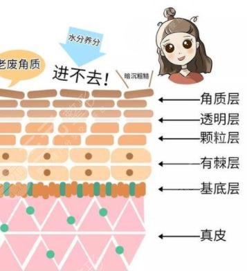 去角質(zhì)