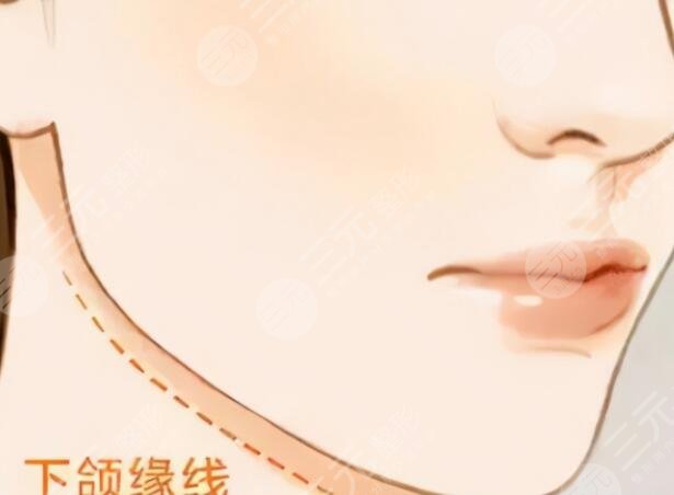 下頜角肥大矯正術(shù)術(shù)后并發(fā)癥有哪些？手術(shù)風(fēng)險(xiǎn)和注意事項(xiàng)才應(yīng)該是關(guān)注重點(diǎn)！