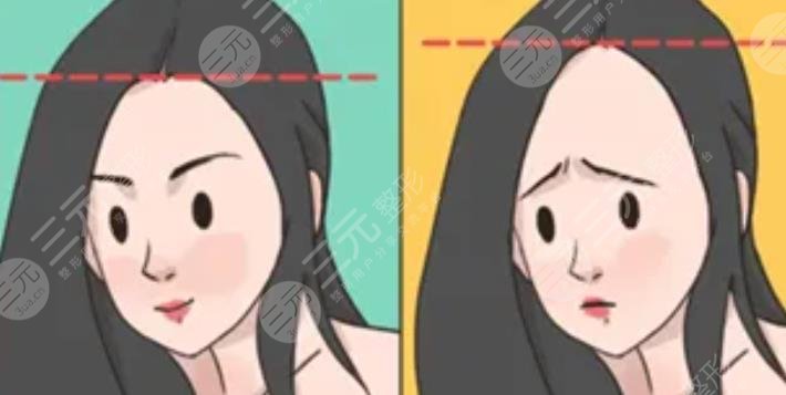 發(fā)際線