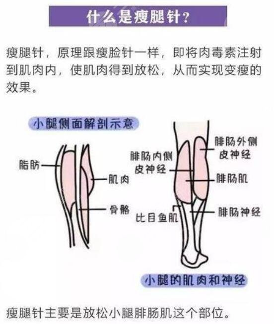 肌肉小腿怎么瘦成筷子腿肚子？