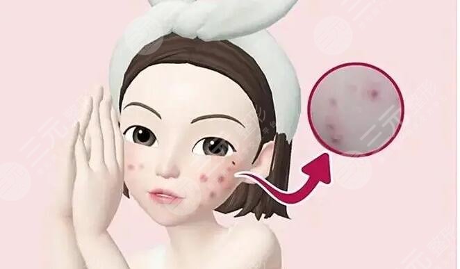痤瘡疤痕怎么治才能徹底？這幾種有方法網(wǎng)友們親測果，給你更好選擇~