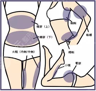 等離子激光溶脂有危害嗎？