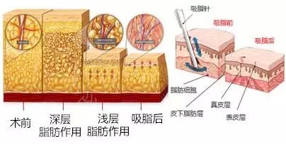 快速有減肥方法有哪些呢?