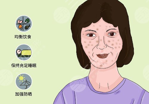 簡單美白祛斑的方法有哪些？