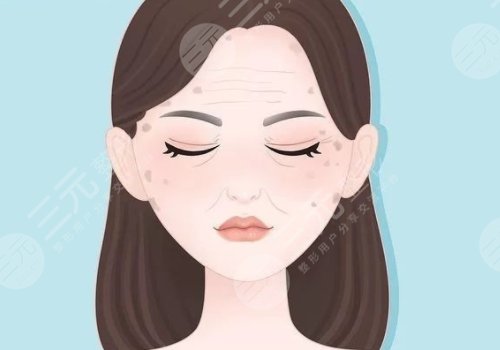 怎樣治老年斑？