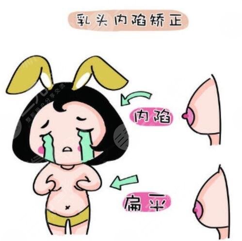 乳頭內(nèi)陷需要注意的事項(xiàng)有什么?