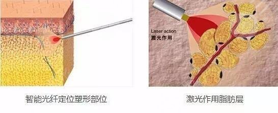 怎樣變瓜子臉？