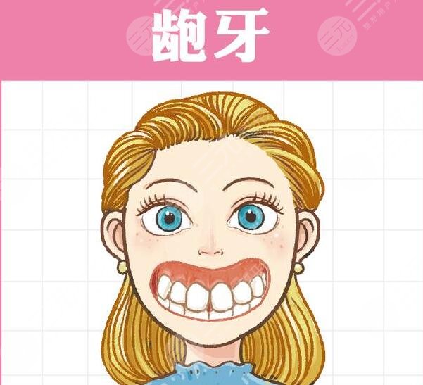 　　美容冠矯正齙牙果嗎?其實這種緩解能夠讓口腔狀態(tài)更加地正常和協(xié)調(diào)，而且也能夠讓牙齒排列的，更加的精美。通過做齙牙的矯正緩解，能夠讓整個人的口腔狀態(tài)看上去更加的自然和協(xié)調(diào)，但是想要通過做美容冠來解決自己的齙牙，這種做法是不推薦的，雖然能夠達到一定的果，但是治標不治本，而且，這種緩解方式，并不適用于所有的齙牙。那么，美容冠矯正齙牙果如何?  　　一、美容冠矯正齙牙果嗎?  　　一般情況下，如果齙牙的程度比較輕的話，那么通過做美容冠緩解能夠達到一定的果，但是嚴重的齙牙，做美容冠其實是沒有作用的，不能夠達到齙牙的緩解果。有些輕度的齙牙，做美容冠是有代價的，而且需要在專業(yè)醫(yī)生的指導下磨出一部分牙齒組織，讓牙齒變得更小，然后重新套一個冠下去，并且，套一個可能沒那么齙的固定冠下去，所以說這種方式有一定的局限性，而且是不值得推薦的。  　　二、齙牙如何緩解?  　　齙牙的緩解方式主要分為拔牙和牙齒矯正，尤其是隱形正畸手術(shù)或金屬正畸手術(shù)。有齙牙的患者，建議去做正畸緩解，通過做該緩解，能夠讓牙齒排列的更加的正?；蛘呷绻麌乐?，還可以去專業(yè)的醫(yī)院完成正頜外科方面的手術(shù)，包括聯(lián)合箍牙、矯牙的緩解來進行矯正。  　　1、做拔牙緩解。其實拔牙緩解能夠讓整個人的口腔狀態(tài)看上去更加的美觀，而且拔出了大多數(shù)的牙齒之后，整個人的口腔狀態(tài)也會更加的協(xié)調(diào)齙牙的存在，也能夠得到更好的改良。  　　2、做牙齒矯正手術(shù)。做牙齒矯正手術(shù)，包括隱形正畸手術(shù)和金屬正畸手術(shù)，而且需要佩戴牙套，再佩戴了牙套之后牙齒才會排列的，更加的整齊和美觀。一般分為隱形的牙套和金屬的牙套，隱形的牙套是可以自行摘戴的，而且美觀都是相對較好的，雖然金屬牙套不能夠自行摘戴，但是能夠起到更好的塑形果，其實也是一種不錯的操作。在佩戴牙套大概一年左右的時間再取下來，整個人的口腔狀態(tài)看上去就會更加的美觀，并且牙齒也會更加的自然和協(xié)調(diào)，一般不會出現(xiàn)劇烈的刺痛感和疼痛感，但是需要對口腔進行一定的護理。  　　3、做正頜手術(shù)。做任何手術(shù)能夠讓牙齒排列的更加的整齊，也能夠讓整個人的牙槽骨看上去更加的自然和協(xié)調(diào)，做完緩解之后牙齒是一般不會脫落的。  　　三、美容冠矯正齙牙的注意事項  　　其實，做牙齒方面的緩解一定要找專業(yè)的醫(yī)生進行操作，不能夠盲目的開展緩解。而且做完緩解之后，也要多吃新鮮的蔬菜和水果，少吃辛辣油膩以及刺激性的食物，不能夠經(jīng)常熬夜，否則可能會影響自己牙齒的恢復。同時也要注重自己日常的口腔清潔和護理，如果出現(xiàn)了牙菌斑滋生的現(xiàn)象，那么就要找醫(yī)生進行一定的緩解，不能夠經(jīng)常不刷牙，否則可能會導致牙齒細菌增多影響口腔的健康。