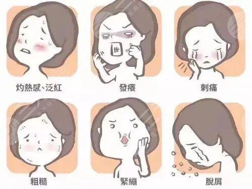 緩解痤瘡的較佳方法