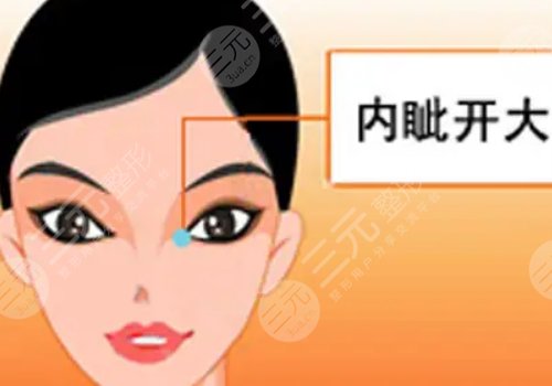 影響開(kāi)內(nèi)眼角手術(shù)價(jià)格的因素有哪些?