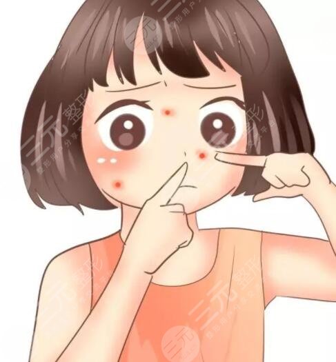 激光手術修復痘印痘坑能夠維持多久?