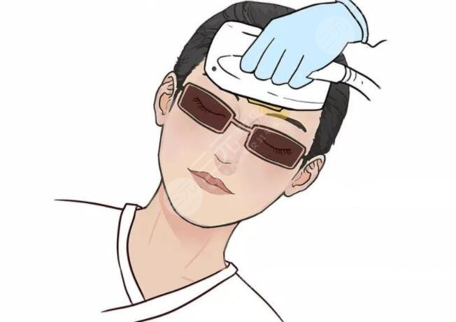 鐳射凈膚介紹