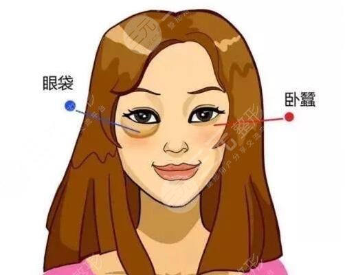 長(zhǎng)眼袋怎么消除?