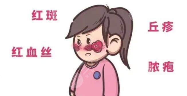 去紅血絲