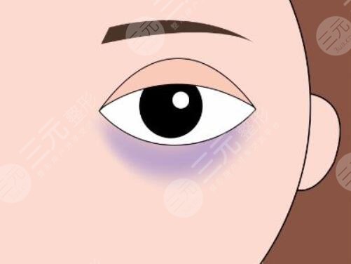 有黑眼圈是怎么回事？先天遺傳、后天因素導(dǎo)致的原因分析，該怎么有效避免？