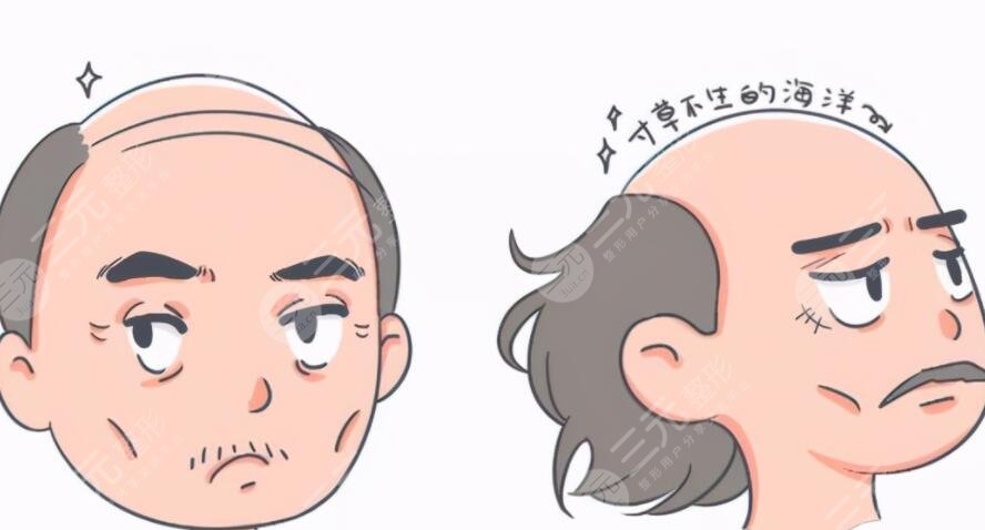 脫發(fā)