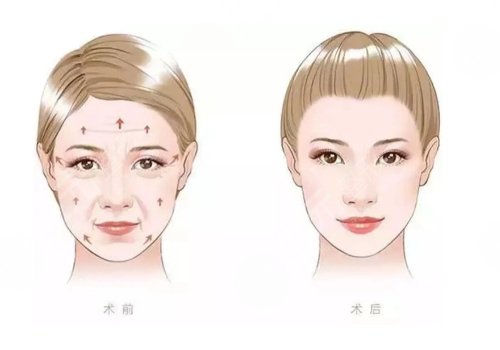 北京清木王宇面吸、填充怎么樣?