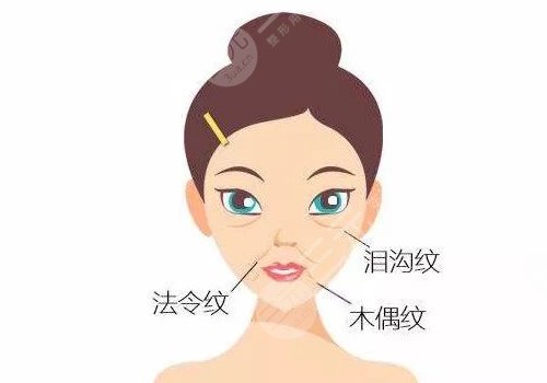 法令紋太深了有什么解決辦法？