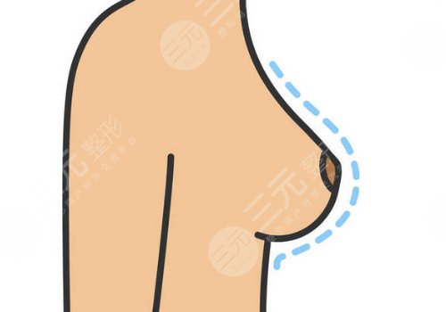 奧美定取出手術后要注意些什么？