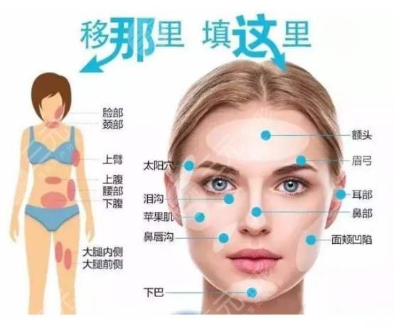 法令紋太深了有什么解決辦法？