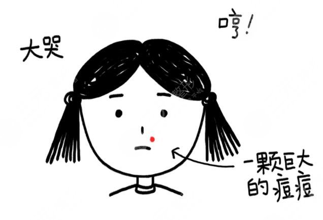 維生素e去痘印