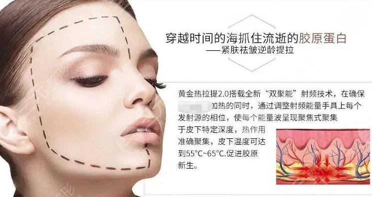 熱拉提做幾次有效果？