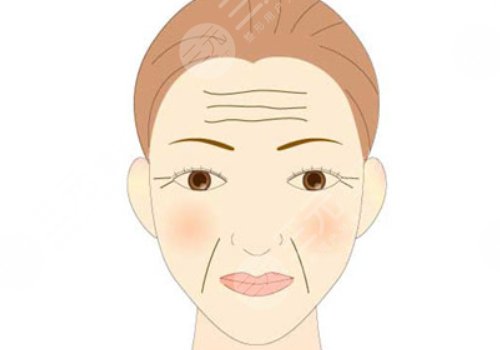 如何去除抬頭紋？