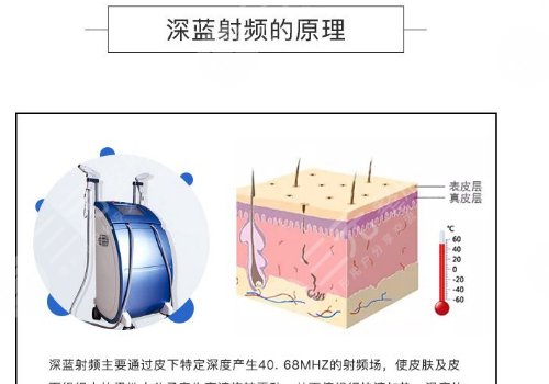 深藍射頻和熱拉提哪個好？