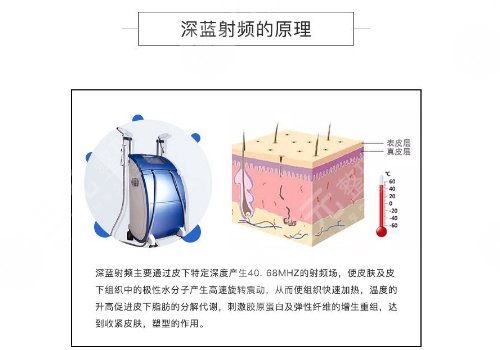 深藍(lán)射頻和熱瑪吉的區(qū)別有哪些？