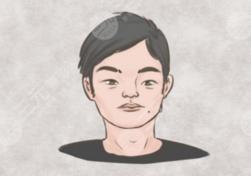 山根有橫紋是怎么回事？