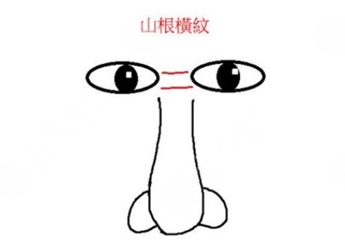 山根有橫紋是怎么回事？