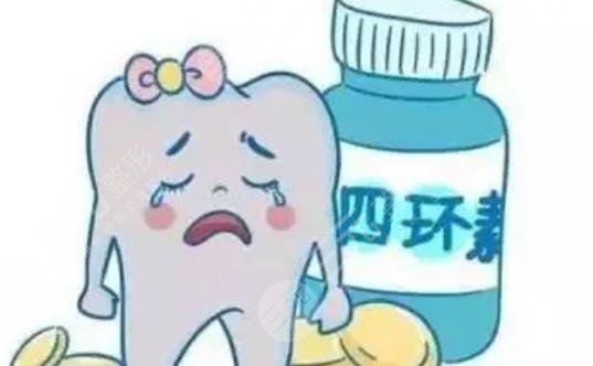 烤瓷牙