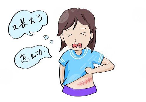 激光去疤痕需要幾次才能徹底消除？