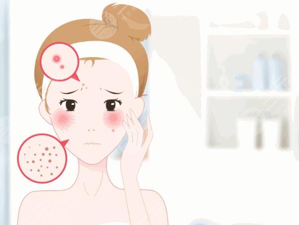 怎么樣祛痘疤效果好？這4種小技巧操作簡單見效快！激光祛疤是優(yōu)選！