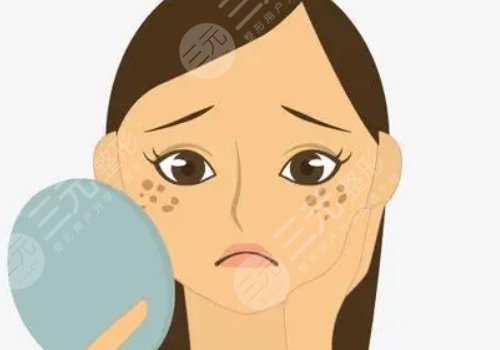 激光祛斑會(huì)不會(huì)反彈？需要做幾次？