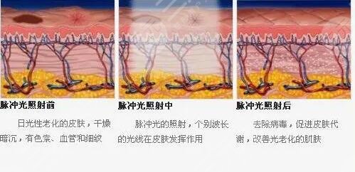 臉上的紅血絲怎么辦?