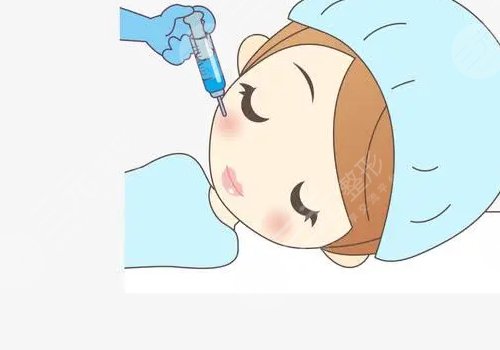 注射瘦臉會(huì)反彈嗎？
