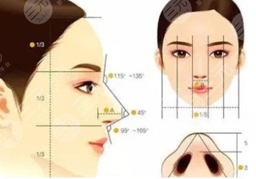 隆鼻假體取出來后能恢復(fù)到以前嗎？