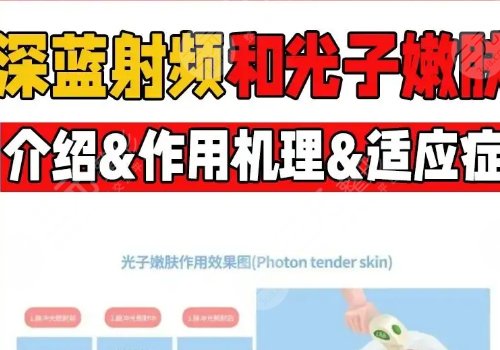 深藍射頻和光子嫩膚哪個好？