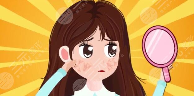 激光嫩膚價(jià)格是多少?