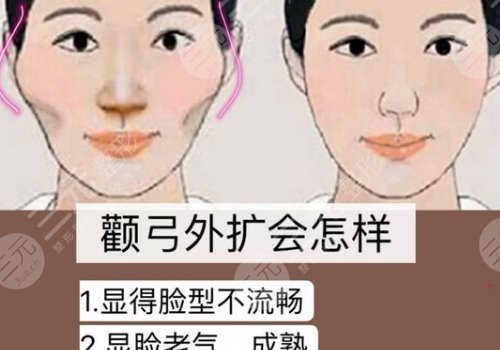 杭州時(shí)光陳小平顴骨下顎骨技術(shù)怎么樣？
