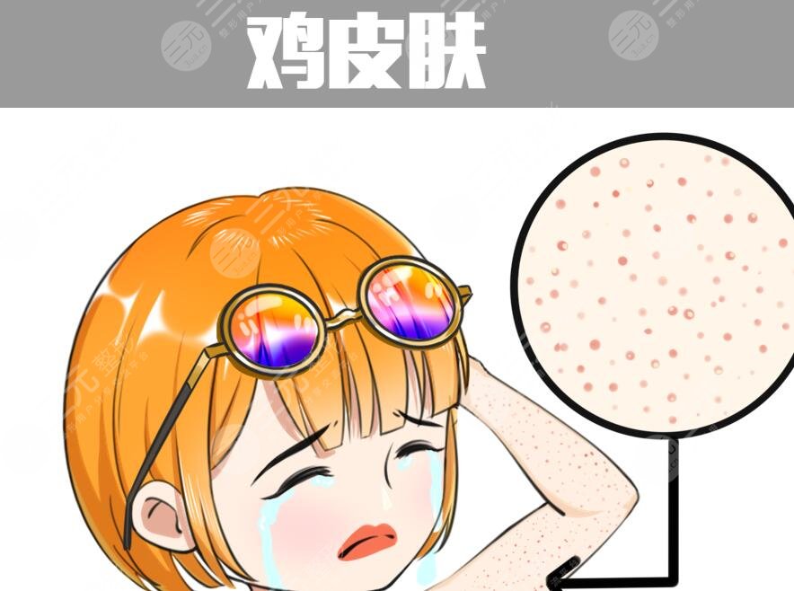 雞皮疙瘩皮膚怎么治見(jiàn)效快？預(yù)防和根治雙重入手，避免反復(fù)發(fā)作！